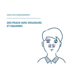 Ducray KELUAL DS - Crème Apaisante - Visage - Peaux Irritées Avec Rougeurs Et Squames, 40ml -Boticinal Powersanté Soldes Boutique ducray kelual ds creme apaisante visage boticinal4